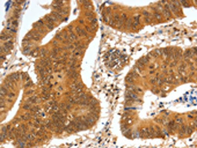 SPDEF Antibody