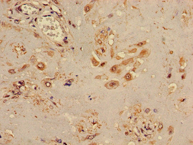 TINF2 Antibody