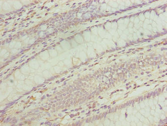 TMEM243 Antibody