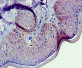 GNL3 Antibody