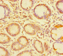 TDRD1 Antibody