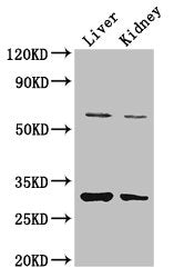 PANK2 Antibody