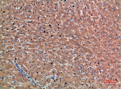 CHRD Antibody