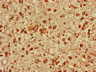 TOLLIP Antibody