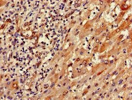 SEMA6A Antibody