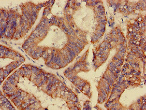 GPAM Antibody