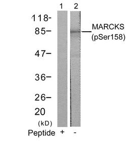 Phospho-MARCKS (Ser158) Antibody