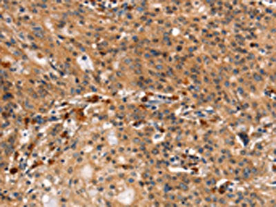 DCLK1 Antibody
