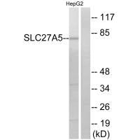 SLC27A5 Antibody