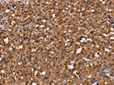 HDLBP Antibody
