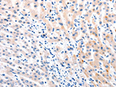 MTOR Antibody