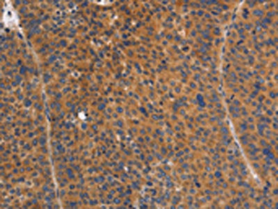 NOD1 Antibody