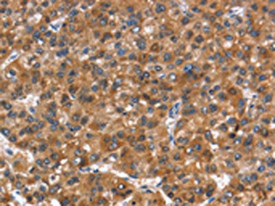NOD2 Antibody