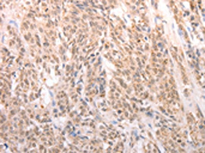 ACIN1 Antibody
