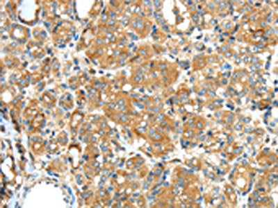 F2 Antibody