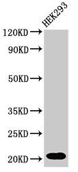 RPS10P5 Antibody