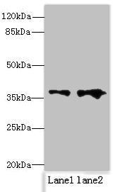 RPRD1B Antibody