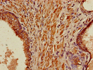 PIH1D3 Antibody