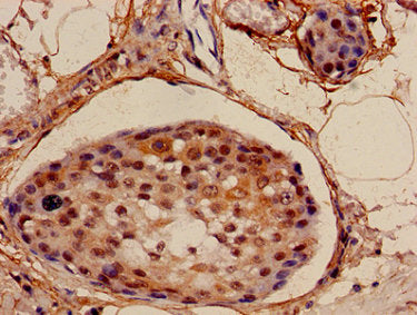 NDUFA4L2 Antibody
