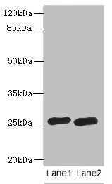 RAB20 Antibody