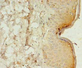 SPANXC Antibody
