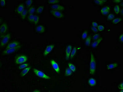 FKBP11 Antibody