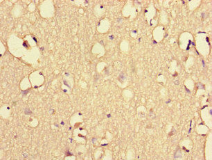 EHD3 Antibody