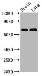 SELENON Antibody