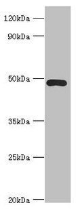 ACTR3B Antibody
