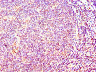 ACTR3B Antibody