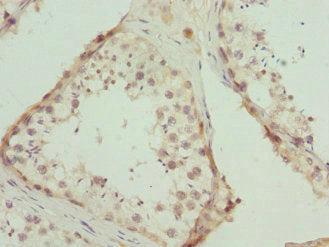 CALCOCO1 Antibody
