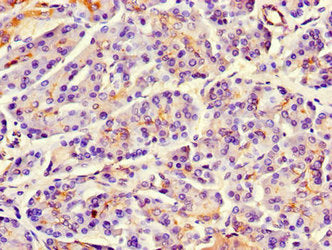 MAP10 Antibody