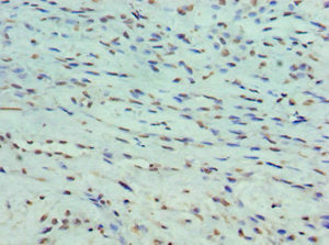 PPP1R1B Antibody