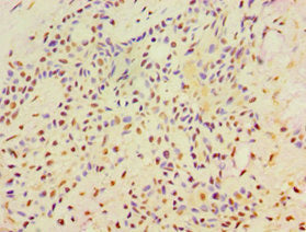 SRRT Antibody