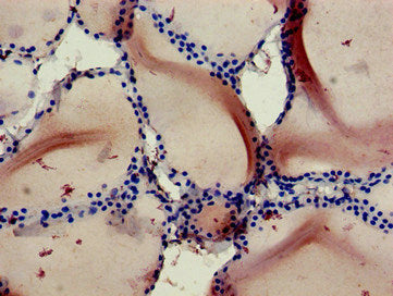 RBCK1 Antibody