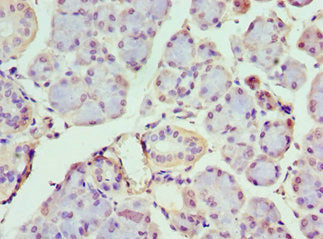 IFIH1 Antibody
