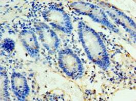 ULBP2 Antibody