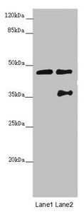 CEP44 Antibody