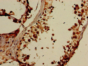ELOVL4 Antibody