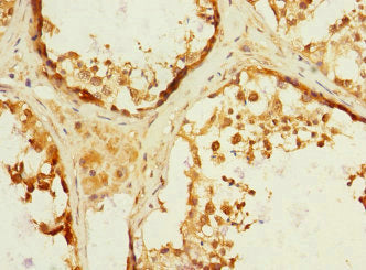 ADAM19 Antibody