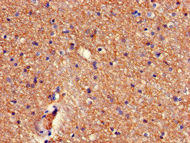 RBM38 Antibody