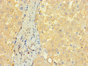 CCDC68 Antibody