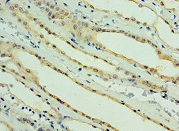 PARL Antibody
