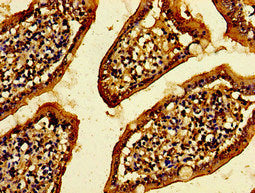 CXorf56 Antibody