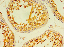 EDA2R Antibody