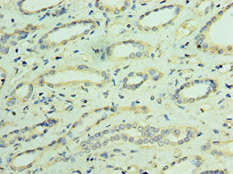 TRPV4 Antibody