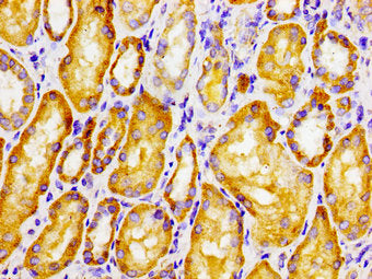 CLN6 Antibody