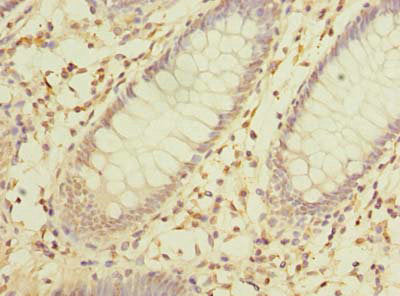MRPL16 Antibody