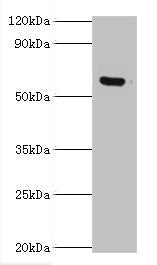 MKS1 Antibody