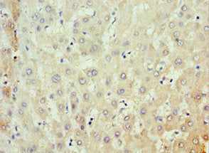 MKS1 Antibody